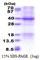 Human RETN / Resistin Protein (Recombinant His)
