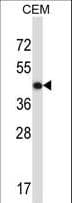 PathPlus™ ACTG2 Antibody (aa343-371)
