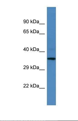 Polyclonal Rabbit anti-Human CENPU / MLF1IP Antibody (aa80-129, WB)