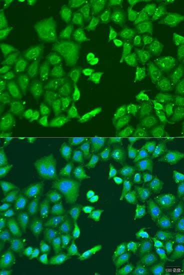 CYP11B1 Antibody