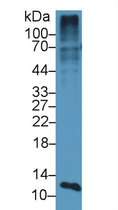 S100A4 / FSP1 Antibody (aa1-101, PE)