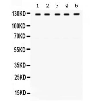 TRPM8 Antibody (aa1068-1104)