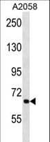 Polyclonal Rabbit anti-Human ATG9A Antibody (aa252-281, IHC, WB)
