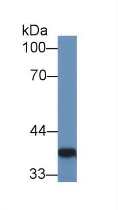 GAL4 / Galectin 4 Antibody (aa19-324, Cy3)