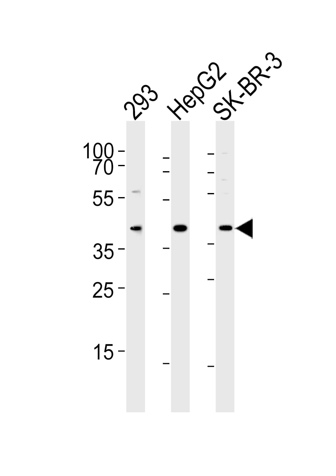 ACAT1 Antibody (aa393-426)