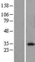 STOM / Stomatin Protein (Over-Expression Lysate Myc-DDK (Flag))