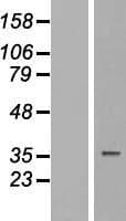 TUSC3 Protein (Over-Expression Lysate Myc-DDK (Flag))