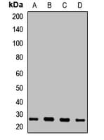 CLTB Antibody
