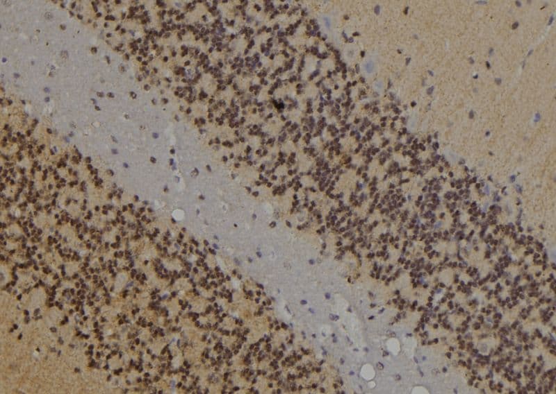 Polyclonal Rabbit anti-Human JUNB / JUN-B Antibody (IHC, WB)