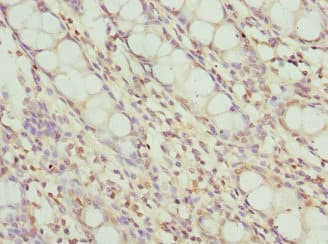 FRK Antibody