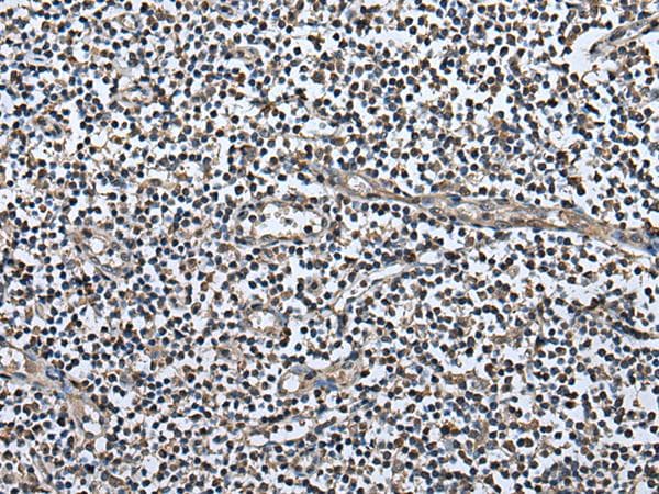 UTP3 / CRLZ1 Antibody