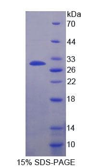 Cow Alpha-S1-Casein / CSN1S1 Protein (Recombinant His, N-Terminal)