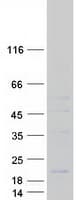 Human MRPL41 / PIG3 / BMRP Protein (Recombinant Myc-DDK (Flag))