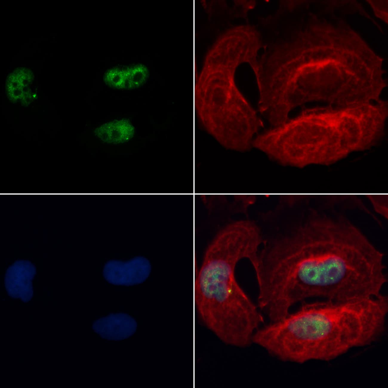 BBX Antibody