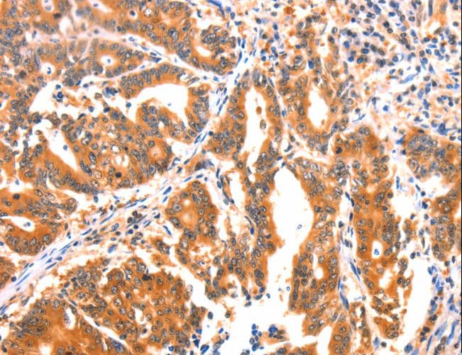 AK5 / Adenylate Kinase 5 Antibody