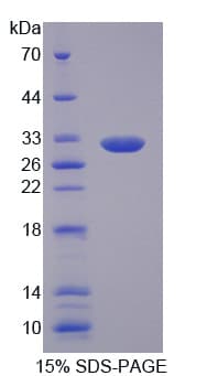 Human MFAP4 Protein (Recombinant His)