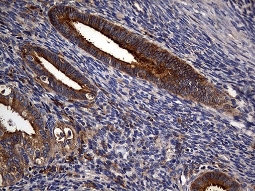 Monoclonal Mouse anti-Human CPM / Carboxypeptidase M Antibody (clone OTI4E11, aa124-423, IHC, WB)