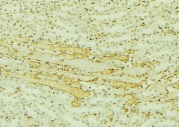 Polyclonal Rabbit anti-Human C10orf2 / PEO1 Antibody (IHC, WB)