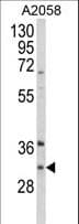 ING5 Antibody (aa91-119)