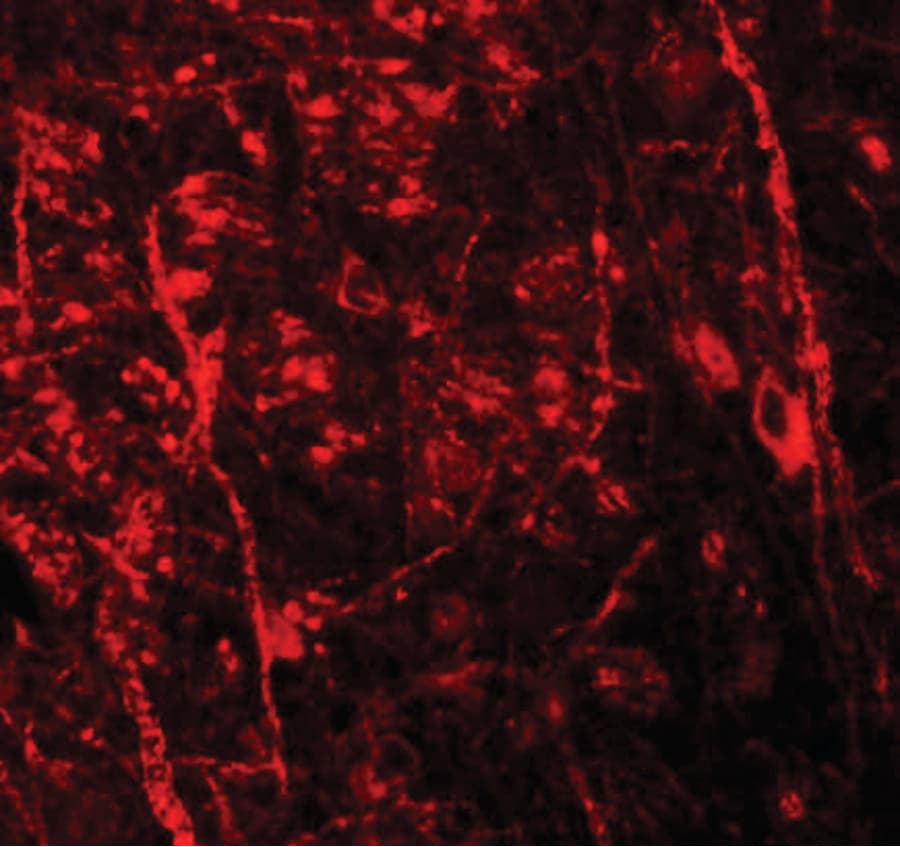 IHC-plus™ NKX3-2 / BAPX1 Antibody