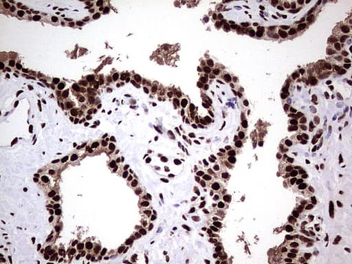C14orf166 Antibody (clone UMAB175)