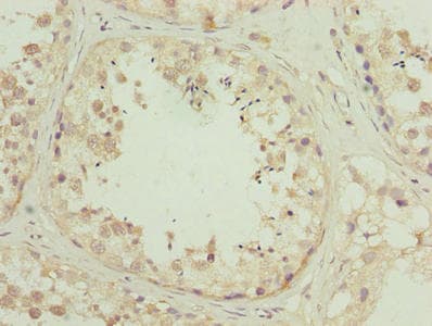 ZNF622 Antibody