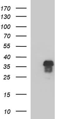 ZFAND3 / TEX27 Antibody (clone OTI1H9)