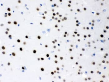 MEF2A / MEF2 Antibody