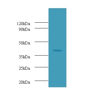 IHC-plus™ UBE2Q2 Antibody (aa1-375)