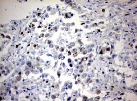 MKI67 / Ki67 Antibody (aa1160-1493, clone OTI9D4)