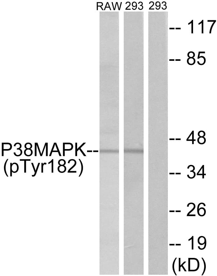 MAPK14 / p38 Antibody (phospho-Tyr182)