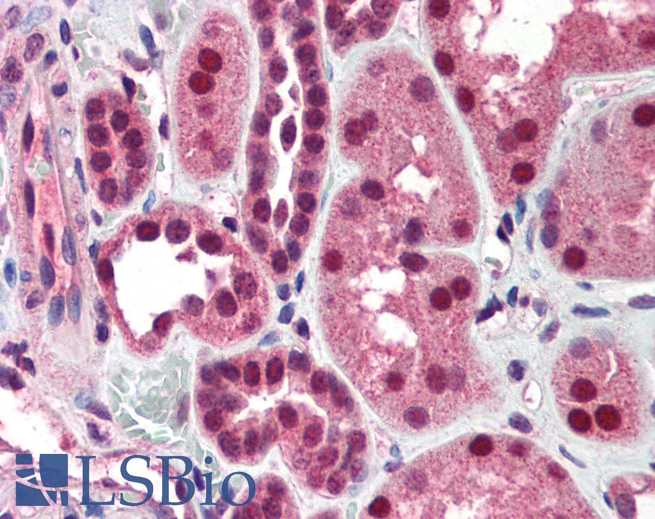 IHC-plus™ Polyclonal Rabbit anti-Human DFFB Antibody (IHC, IF, WB)