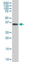 Monoclonal Mouse anti-Human DCPS Antibody (clone 3E5, WB)