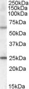 COL4A3BP / CERT Antibody (aa662-672)