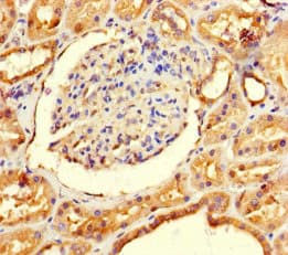 GALM / Mutarotase Antibody