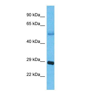 APH1B Antibody (aa59-108)