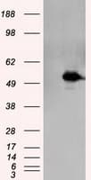 TLDC1 / KIAA1609 Antibody (clone OTI12B1)