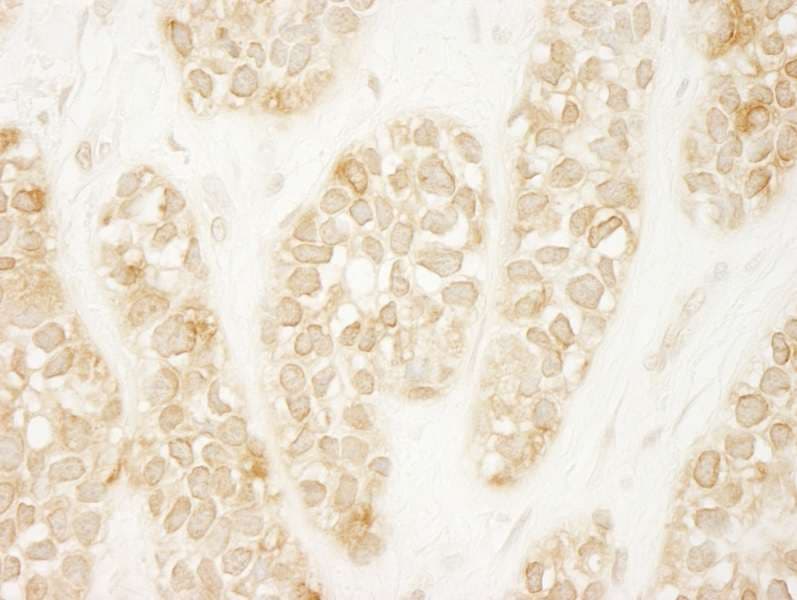 ARHGEF16 Antibody (aa175-225)