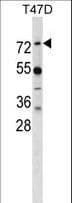 MX1 / MX Antibody (aa409-437)