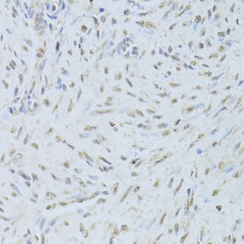 TDP-43 / TARDBP Antibody
