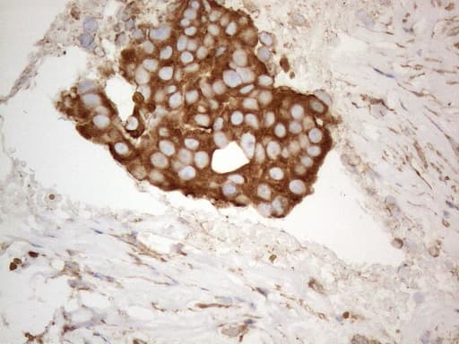 VAP33 / VAPA Antibody (aa2-227, clone OTI10E10)