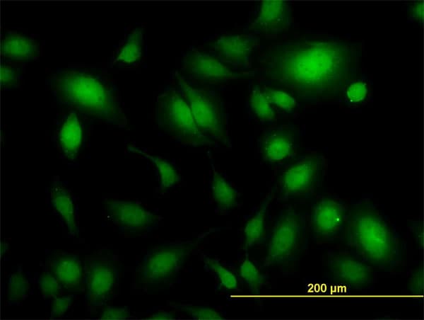 USP34 Antibody (clone 2E2)