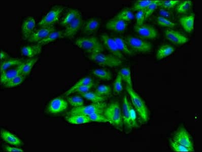Polyclonal Rabbit anti-Human GPR183 / EBI2 Antibody