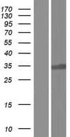 Human USB1 Protein (Over-Expression Lysate Myc-DDK (Flag))