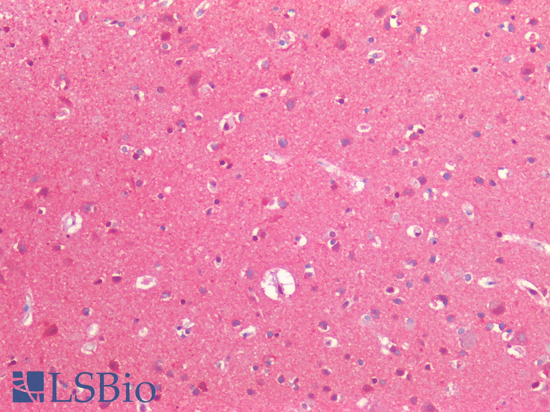 IHC-plus™ Polyclonal Rabbit anti-Human NEDD8 Antibody (IHC)