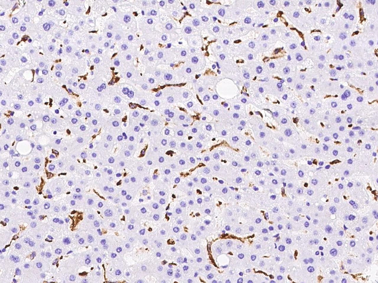 CD163 Antibody