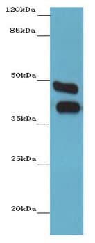 IHC-plus™ Polyclonal Rabbit anti-Human CA12 / Carbonic Anhydrase XII Antibody (aa25-301, IHC, WB)