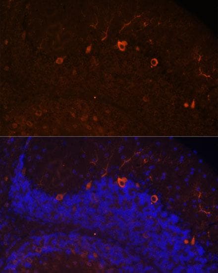 Polyclonal Rabbit anti-Human ANOS1 / Anosmin Antibody (IF)