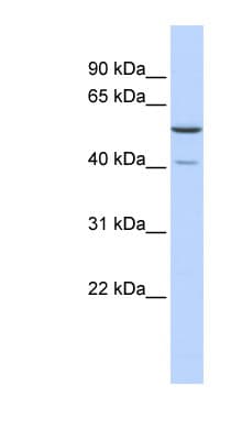 Polyclonal Rabbit anti-Human METTL15 / METT5D1 Antibody (N-Terminus, WB)