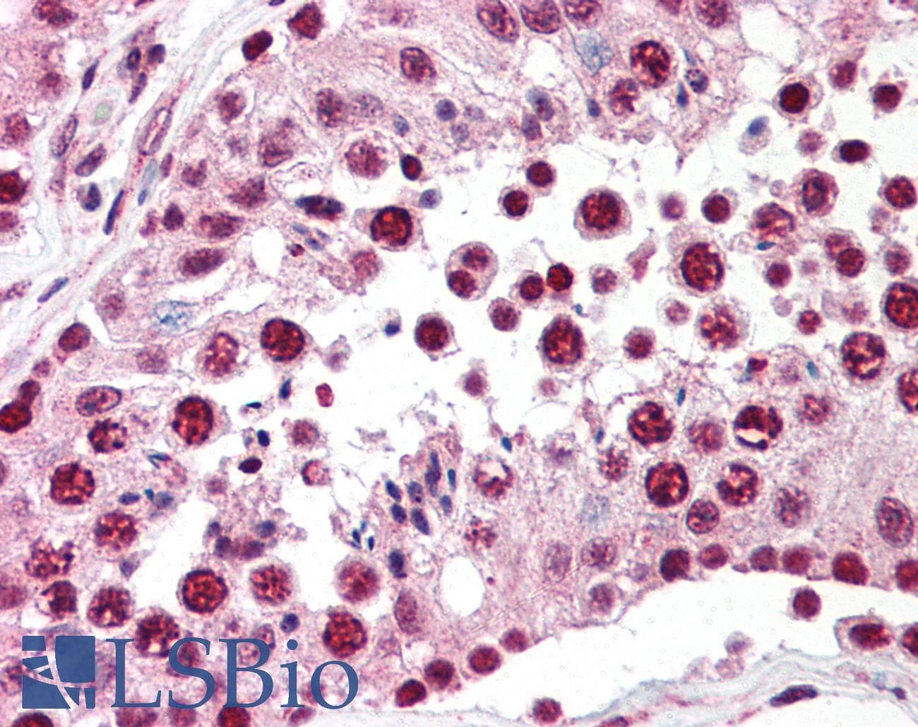 IHC-plus™ Polyclonal Rabbit anti-Human SPANXC / SPANX-C Antibody (IHC, WB)